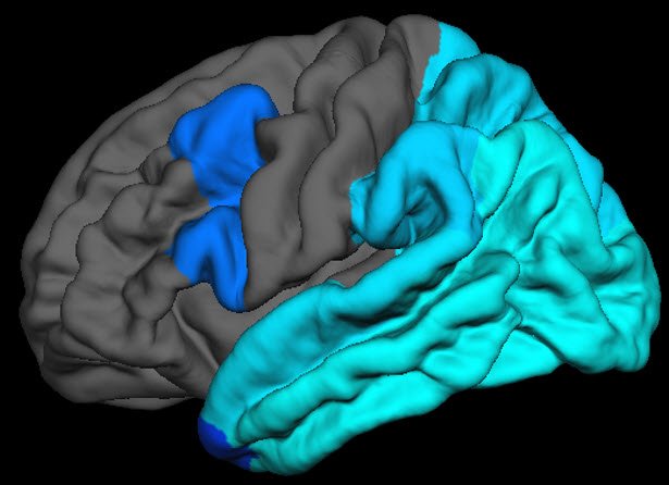 Benzinger Neuroimaging Laboratory