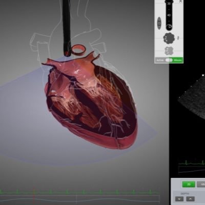 Grupo de expertos en ecocardiografía transesofágica y transtoracica y ecografía abdominal y pulmonar para enseñanza práctica en España. Echo Education