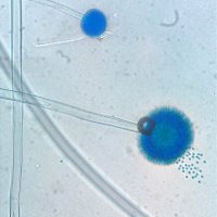 Infectious Diseases at Austin Health (@id_austin) 's Twitter Profile