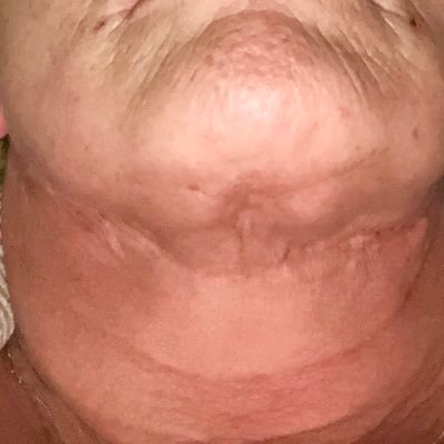 Cynthia98614831's profile picture. A consumer who got plastic surgery and was butchered at Elite MD