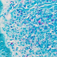 Kenya Association of Clinical Pathologists (KACP) (@kenyakacp) 's Twitter Profile