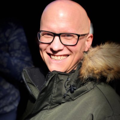 West Ham, marketing, gardening, drastic sudden hair loss