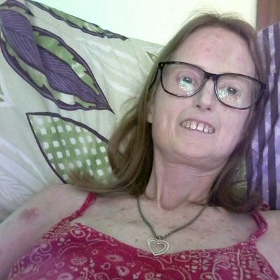 Writer. Ex-nurse. Health, human rights incl. right to Good Death. Winner of rare autoimmune disease - scleroderma. Media 👍 Planet care. RT =?👍?👎 ✌️