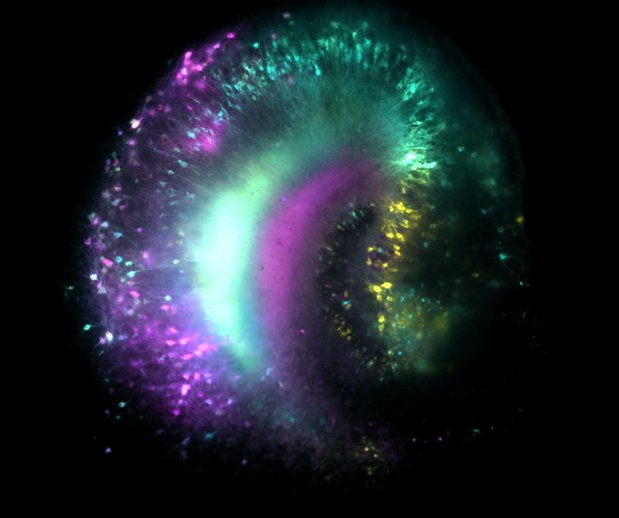 Assistant Professor @MGHNeurology @harvardmed. Using novel optical approaches to understand how epileptic networks form 🔬🧠