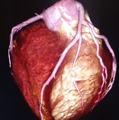 GilmarACD's profile picture. 