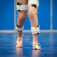 UoS_KneeAnkleFoot (@kneeanklefoot) 's Twitter Profile