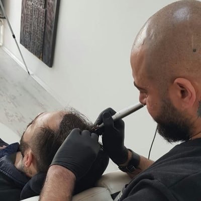 Köln keup https://t.co/hGyx2qKjCP Stüdyomda Hair Pigmentation (saç similasyonu)yöntemiyle saçlariniza daha gür ve sık bir görüntü veriyorum.Numaram:+491639525809