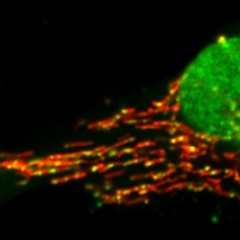 Mitochondrial research lab at the University of Calgary
@mitomorph.bsky.social