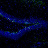 Researching the Brain (@brain_database) 's Twitter Profile Photo Researching the Brain (@brain_database) 's Twitter Profile Photo