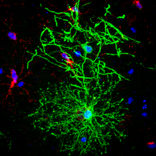 Glial Research Team led by Professor Kaylene Young at the Menzies Institute for Medical Research @UTAS_