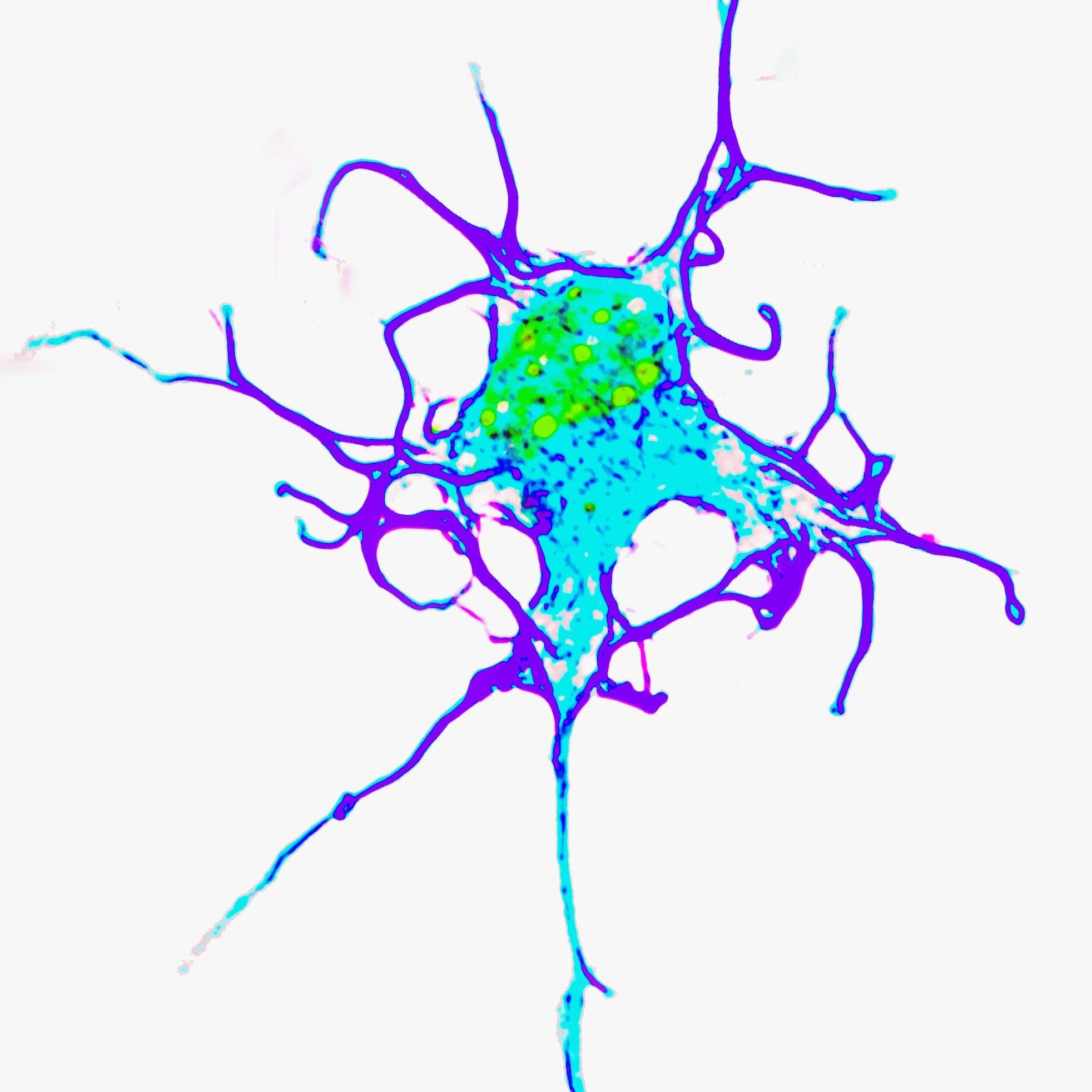 We study mRNA processing defects and protein aggregation in SMA, ALS/FTD, AD, and related neurodegenerative diseases. (Views expressed in my tweets are my own.)