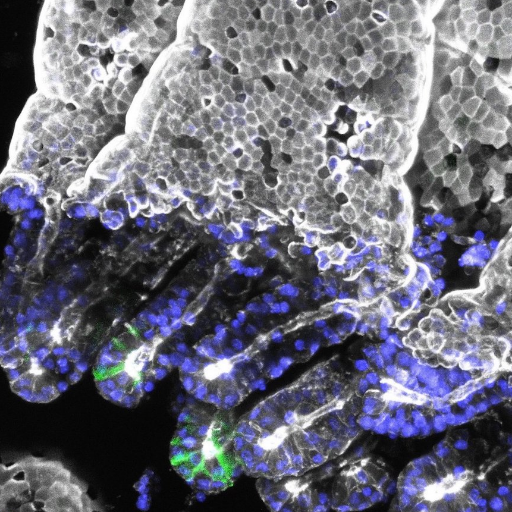 Lab of Pekka Katajisto @PekkaKatajisto @helsinkiuni and @karolinskainst We work on #aging, #stemcell #metabolism and more https://t.co/aS1s7OrlGk