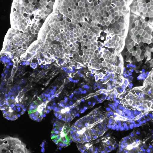 Lab of Pekka Katajisto @PekkaKatajisto @helsinkiuni and @karolinskainst We work on #aging, #stemcell and #niche interactions, #metabolism, #organelle asymmetry