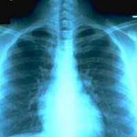 RadiologyTrader (@radiologytrader) 's Twitter Profile
