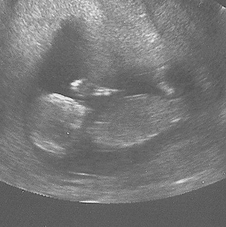 BabyTagebuch's profile picture. Wir sind schwanger (Termin Feb. 11) und wollen alle Interessierte an dieser aufregenden Zeit teilhaben lassen. Bitte habt Verständnis für Pseudonym bis Geburt.