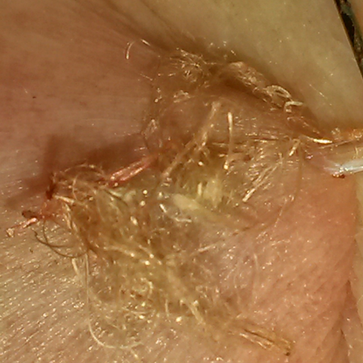 FLDF_FIBRO_LYME's profile picture. The Fibrelos Study, FLDF., Lyme Disease, Fibromyalgia, Lupus, ALS, website: https://t.co/nzyUu2y4cJ