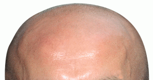 smbldfrndsys's profile picture. I'm bald. Weird shit comes out of my mouth.