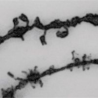 Aldridge Lab (@aldridge_lab) 's Twitter Profile