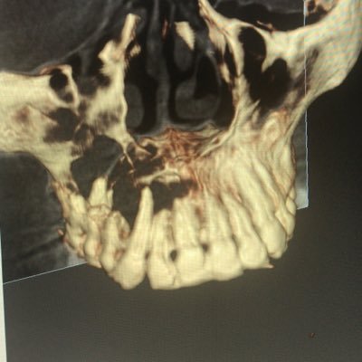 DAVIDVI41039959's profile picture. Cirujano Maxilofacial