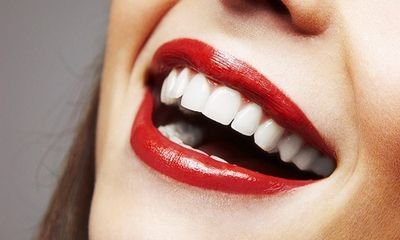 TeethCynthia's profile picture. 14 years FDA certificated teeth whitening products factory, teeth whitening kit/gel/light, DM for your logo printing, cynthia@goopoolbeauty.com
