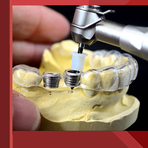 Editorial Assistant Cientific Group Pte Ltd
#Dental #Oral_implant #Root_canal #Forensic_dentistry