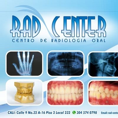 somos el centro radiologico de tu preferencia para realizar tus examenes radiograficos al iniciar cualquier tratamiento odontologico. #rad-center @rad-center