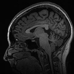 alise_db's profile picture. Clinical Ethics Fellow | Bioethics | Mad & Disability Studies | Peer & Social Work | SoTL & HigherEd... they/them