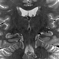 Hippocampal Subfield Group @hipposubfields on bsky (@hipposubfields) 's Twitter Profile Photo Hippocampal Subfield Group @hipposubfields on bsky (@hipposubfields) 's Twitter Profile Photo