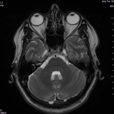 Trina (Tree) Herbert 💙 Profile