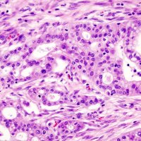 MSKCC Center for Pancreatic Cancer Research (@cpcrmsk) 's Twitter Profile