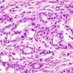 MSKCC Center for Pancreatic Cancer Research (@cpcrmsk) Twitter profile photo MSKCC Center for Pancreatic Cancer Research (@cpcrmsk) Twitter profile photo