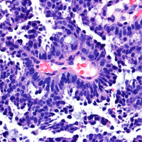 Ana Marques (@ampathology) 's Twitter Profile