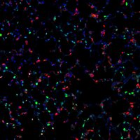 lungdevelopment (@lungdevelopmen1) 's Twitter Profile Photo