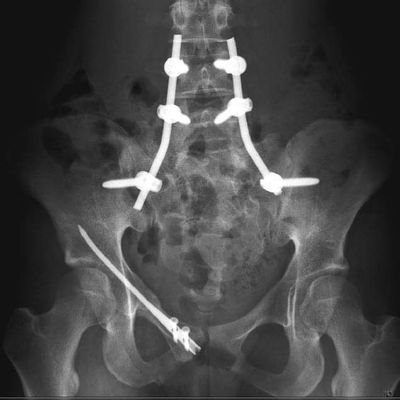 victorzingel's profile picture. Traumatologue Orthopédiste