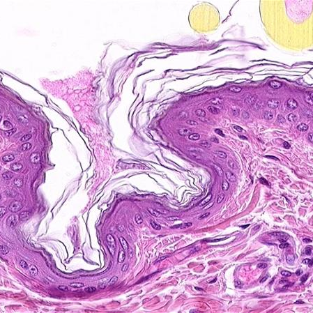 Dermatology, Psoriasis, Eczema, skin cancer.
We help to find useful new science.
Private initative to help good science getting into daily practice.