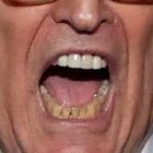 I am Rudy Giuliani’s brown, stained lower teeth. You can use white strips on the lower teeth too, Rudy!
