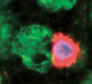 Schwab lab at the Department of Neurology - University Clinics Muenster, Germany. Clinical & Translational Neuroimmunology.