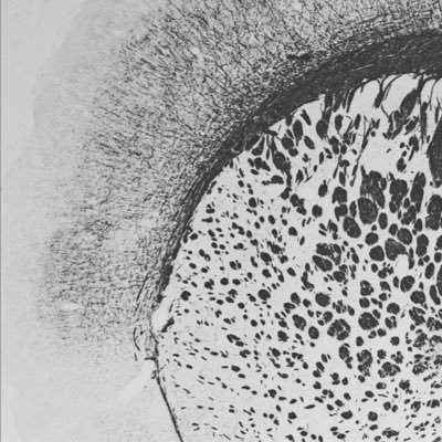 pouladilab's profile picture. We use genetics to understand brain disorders, with a special interest in glia, myelin, and white matter pathology. @bcchresearch @ubc