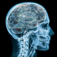 Emory Neuroradiology (@emoryneurorads) 's Twitter Profile