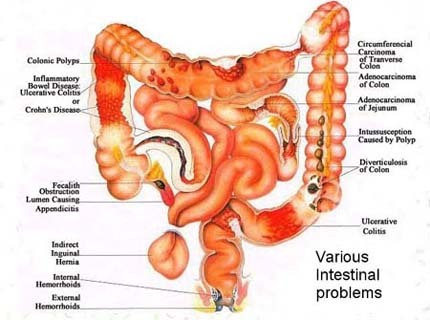 to promote cancer symptoms awareness to reduce mortality rates.