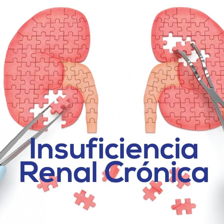 La Insuficiencia Renal Crónica, consiste en el deterioro progresivo e irreversible de la función renal.