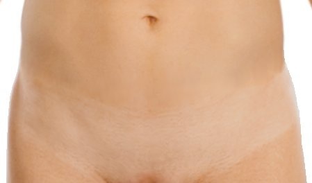 smoothskinjoy's profile picture. Interested in news about methods for reduction of body hair.