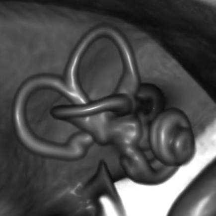 Neuroimaging of the vestibular and the ocular motor system. Effects of long-duration spaceflight on the human brain