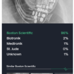 Deep learning pacemaker identification.