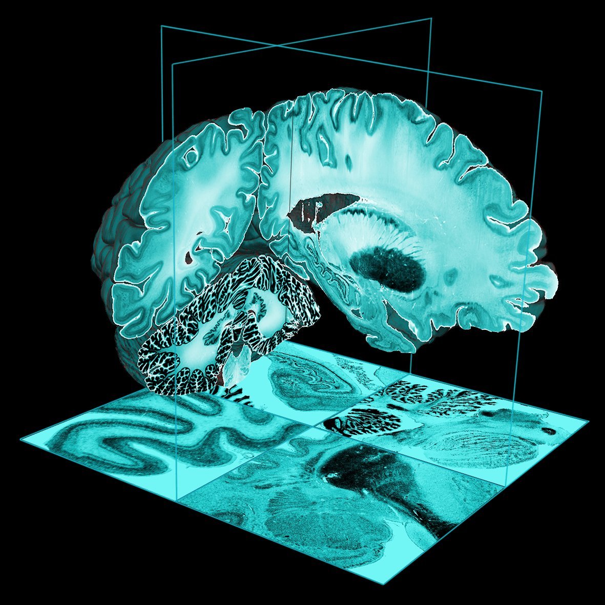 The BigBrain Project is an ultrahigh-resolution3D model of a human brain. It is based at @TheNeuro_MNI and @fz_juelich. Also at LIN https://t.co/OR8uE42a5X