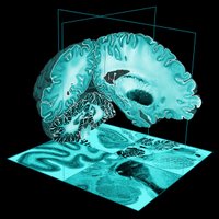 BigBrain (@bigbrainproject) 's Twitter Profile Photo BigBrain (@bigbrainproject) 's Twitter Profile Photo