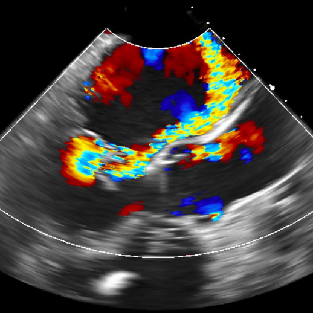 Official Twitter Account of the Delaware Valley Echo Society comprised of Physicians, Sonographers, and interested parties based in Philadelphia, PA.