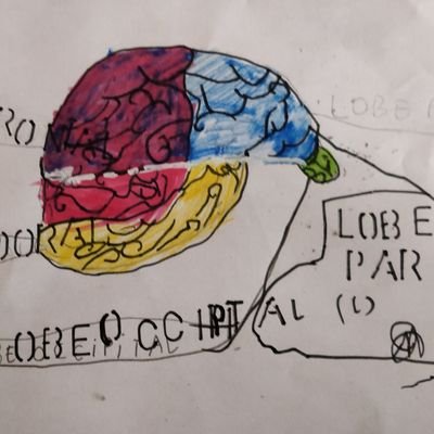 AliAmad_x's profile picture. Psychiatre & chercheur / psychiatrist & researcher / neuropsychiatry /
@medecine_Ulille / @CHU_Lille / @AssoAESP / affiliate @KingsIoPPN