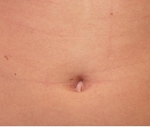 zerobodyhair's profile picture. ZeroBodyHair.com: Permanent home hair removal for men and women. Reviews of the newest and best home devices. Where to buy at best price, worldwide shipping.