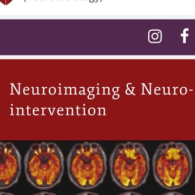 @stanfordneuroi1